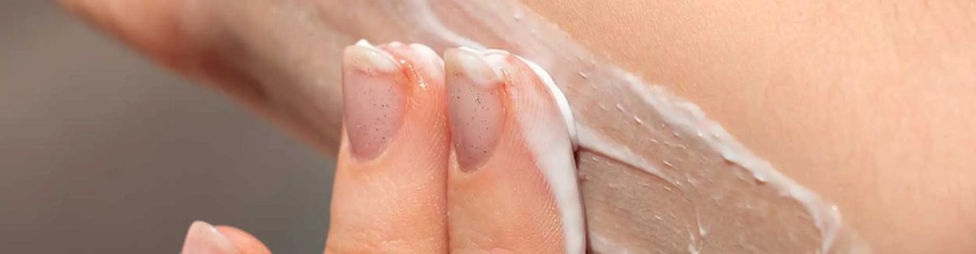Vitiligo Tedavisinde Kortizon Kremi Kullanımı