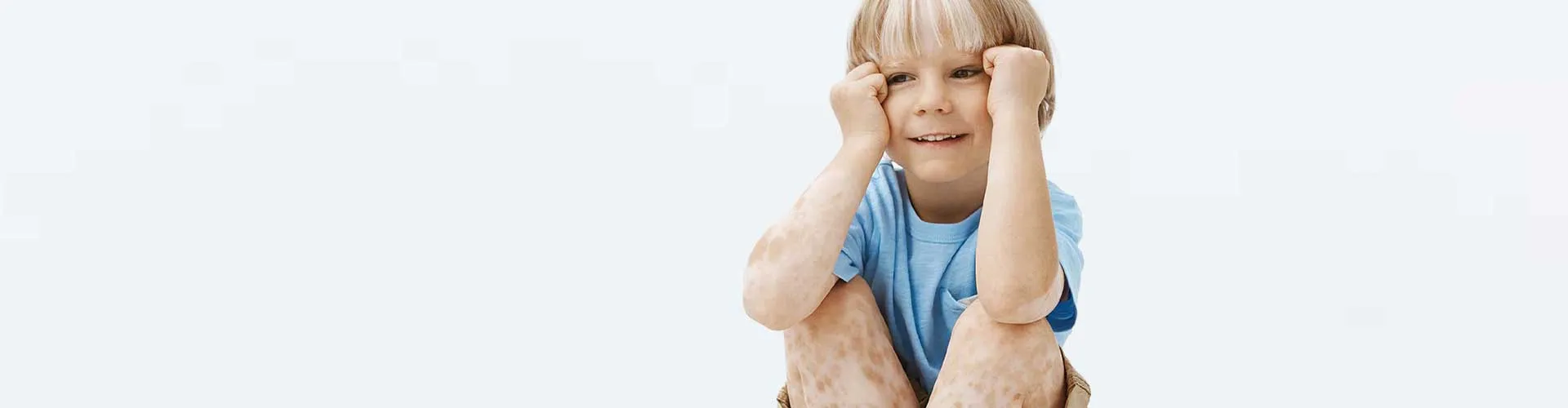 Çocuklarda Vitiligo: Belirtiler ve Yaklaşım Yöntemleri