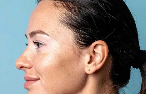 Yüzde Çıkan Beyaz Lekeler Her Zaman Vitiligo Mudur? Ayırıcı Tanılar, Klinik Bulgular ve Dermatolojik İnceleme