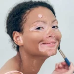 Vitiligo Lekeleri Makyajla Nasıl Kapatılır? Profesyonel Teknikler ve Ürün Önerileri